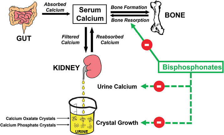 Should Bisphosphonates Be Used By Urologists To Maximize Stone   AU AUAN230981FG001 